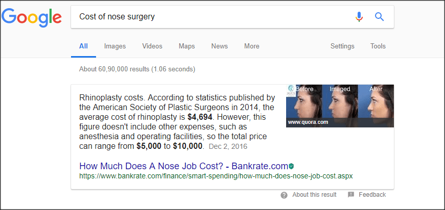 Cost of nose surgery